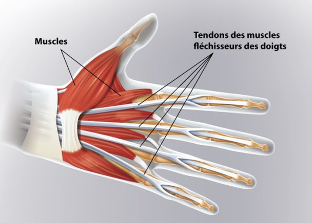 Plaie Des Tendons | Ramsay Santé